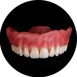 Immagine Protesi a supporto mucoso